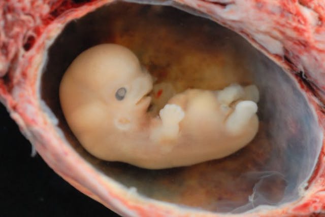 6-7 weeks heartbeat abortion bill, pro-life