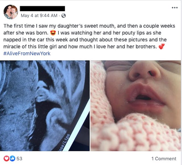 Facebook post on Alive From NY First ever live 4D ultrasound broadcast in Times Square last weekend image