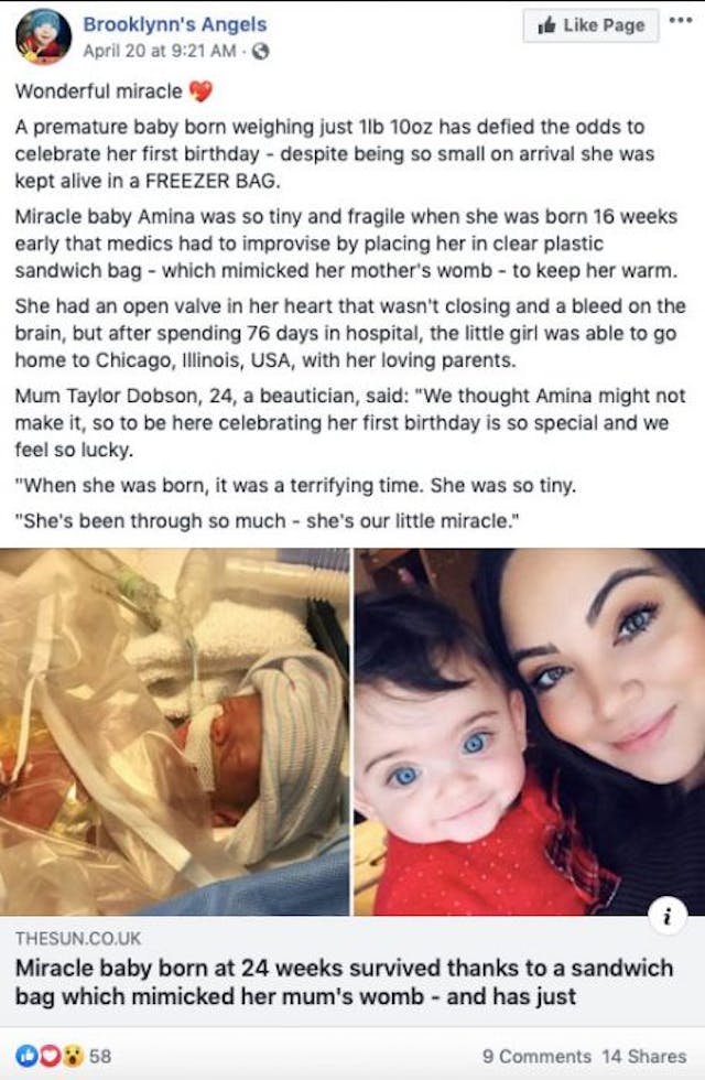 Born 16 weeks premature at a pound, Amina just celebrated her first birthday image