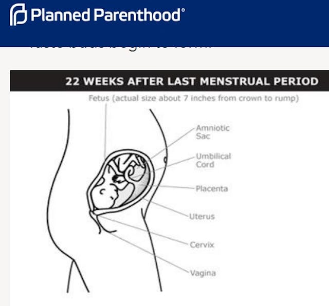 Image: Planned Parenthood fetal development at 22 weeks (Image PPFA website accessed 04162019)