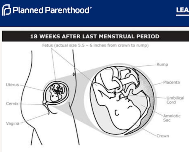 Planned Parenthood fetal development at 18 weeks (Image PPFA website accessed 04162019) Image: Planned Parenthood fetal development at 18 weeks (Image PPFA website accessed 04162019)