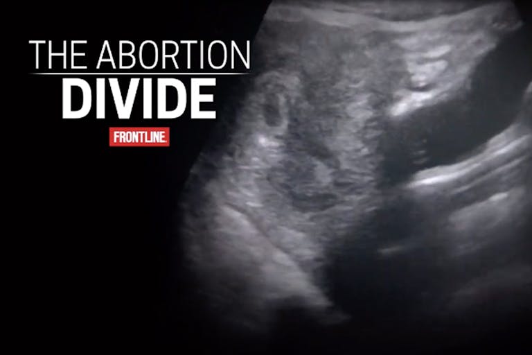 abortion divide