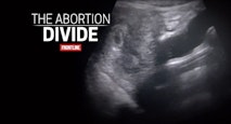 abortion divide
