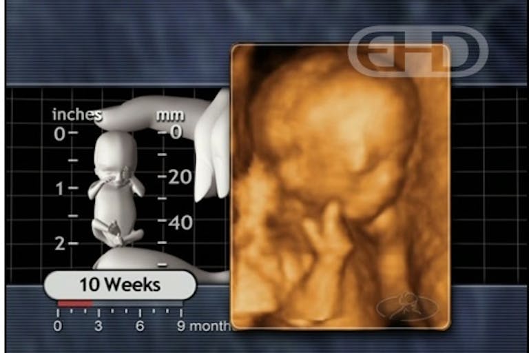 "I am pointing." A baby points to her face at 10 weeks old, in the first trimester.