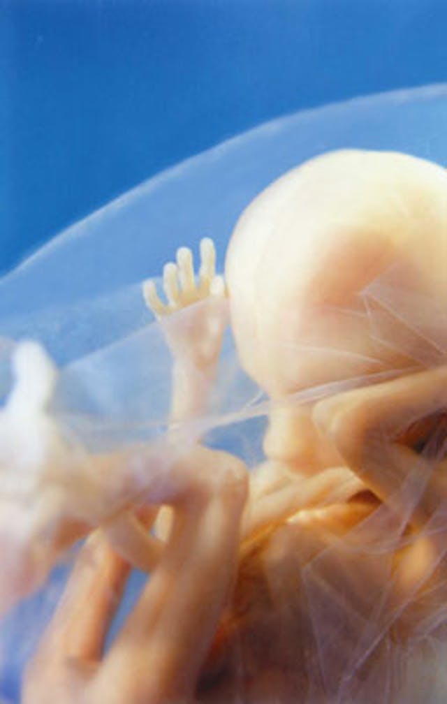 A preborn child at 14 weeks, just before the protection in Mississippi would take effect. A preborn child at 14 weeks, just before the protection in Mississippi would take effect.