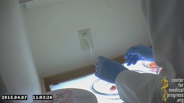 Video screenshot of Planned Parenthood technician sorting body parts of an aborted baby. Planned-Parenthood-fetal-parts3