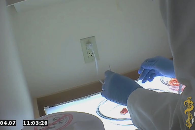 Video screenshot of Planned Parenthood technician sorting body parts of an aborted baby. Planned-Parenthood-fetal-parts3