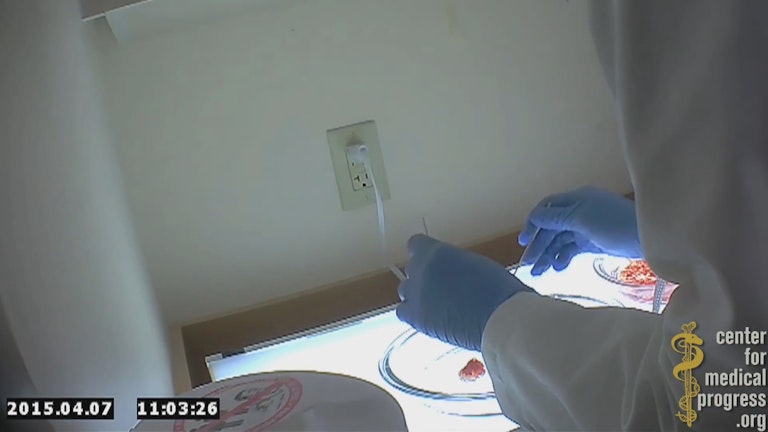 Planned-Parenthood-fetal-parts3