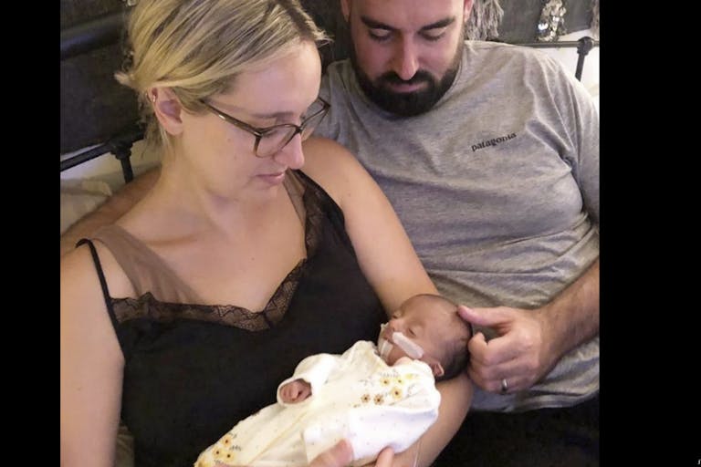 Trisomy 18, Edwards syndrome