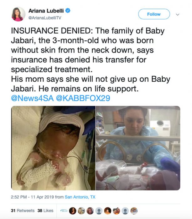 After public outcry, Medicaid allows baby born without skin to be transferred for care image