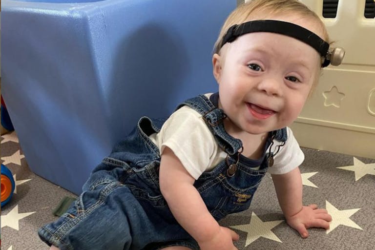 down syndrome