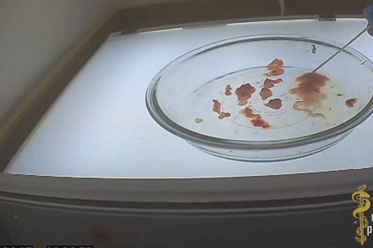 Planned-Parenthood-fetal-parts