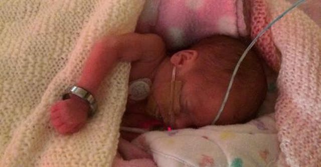 Premature baby weighed just one pound, but is thriving: ‘She is a dream’ image