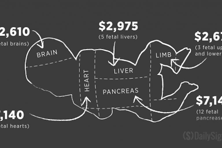 160419_abortion-parts_FEATURE_v4-1250×650-620×322