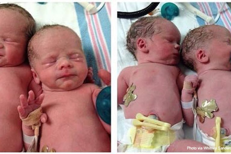 whitney-sanders-twins