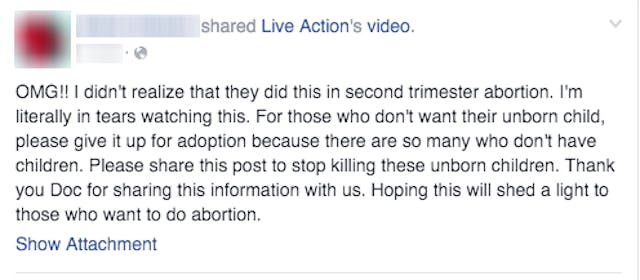 abortion procedures 5