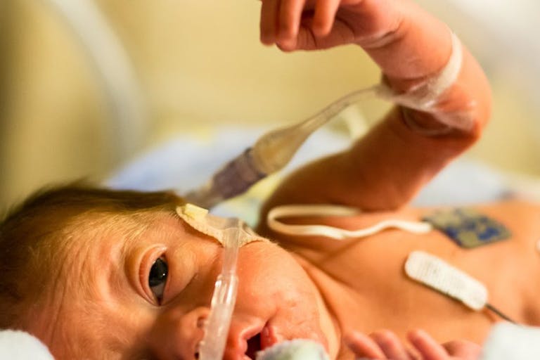preemie, hand, abortions, abortion survivors