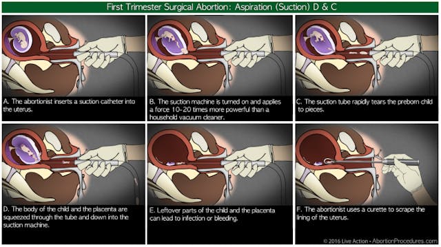 Abortionist involved in 60,000 abortions: There’s ‘no doubt’ the ’embryo is a human being’ image