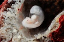 embryos