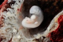 embryos