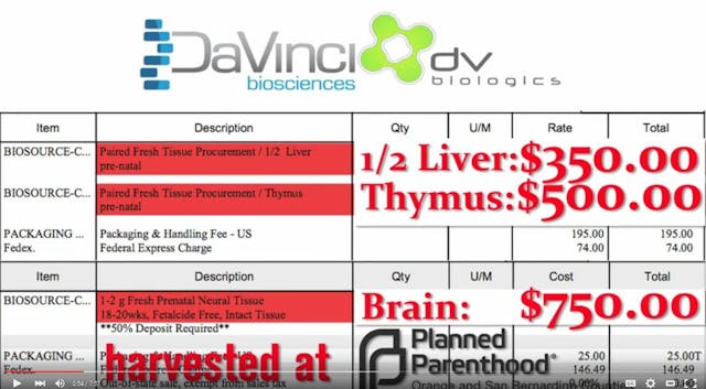 DaVinci Planned Parenthood sells baby parts