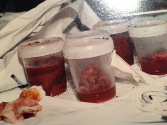 Aborted babies in canister image Aborted babies in canister image