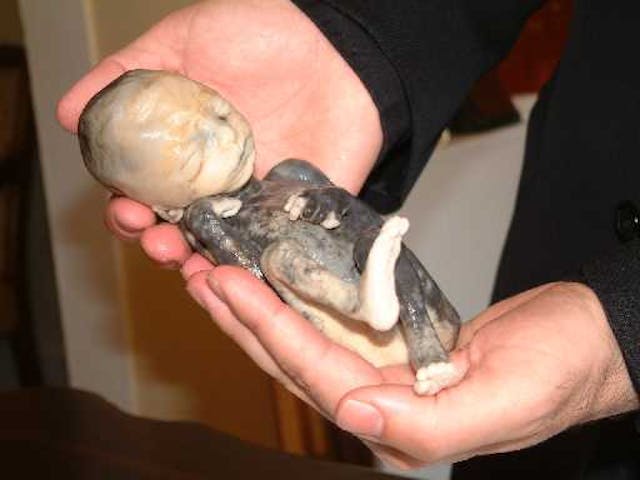 A 1950s photo of an 18-week preborn baby isn’t political. It’s proof of humanity. image