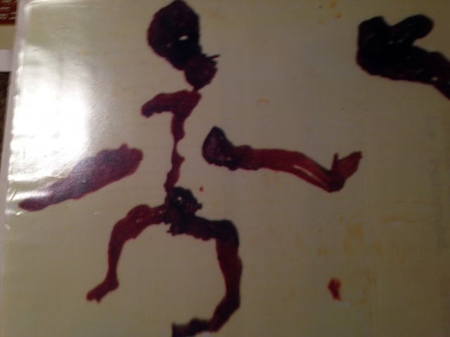 Aborted baby found in trash dumpster