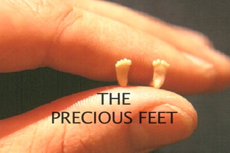 Fetal feet image inspired iconic pro-life precious feet pin (Image credit: Precious Feet on Vimeo) Pro-life women in history: Presidential candidate used platform to denounce abortion image