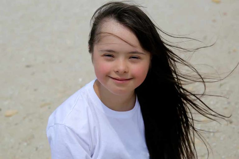 down syndrome girl