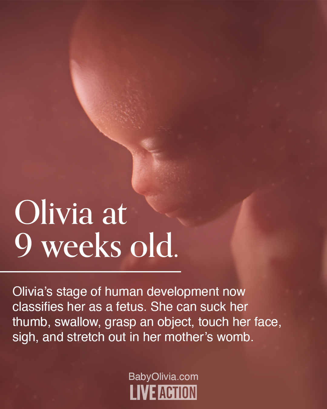 Legal scholars agree ‘viability’ doesn’t determine humanity of preborn children image