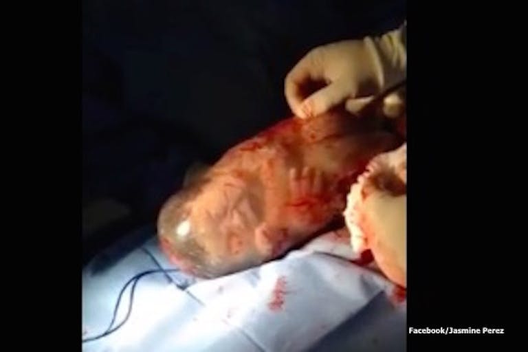 Baby, amniotic sac, born, doctor, Jasmine Perez