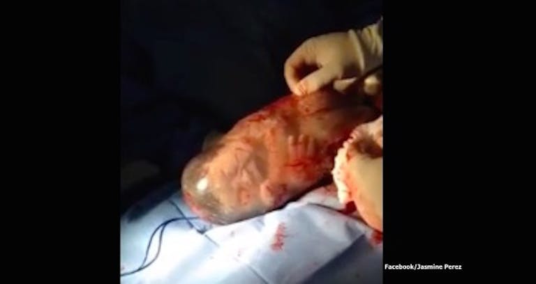 Baby, amniotic sac, born, doctor, Jasmine Perez