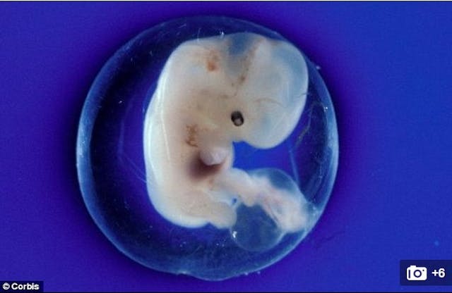 Daily Mail, amniotic sac