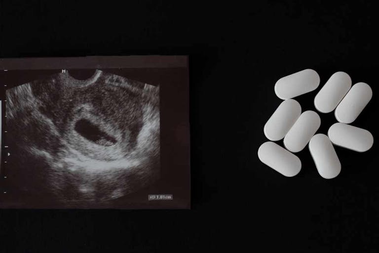 abortion pill, Israel abortion, georgia