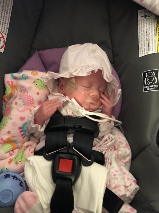 Born premature at 29 weeks, Hannah Joy thrived against all odds image