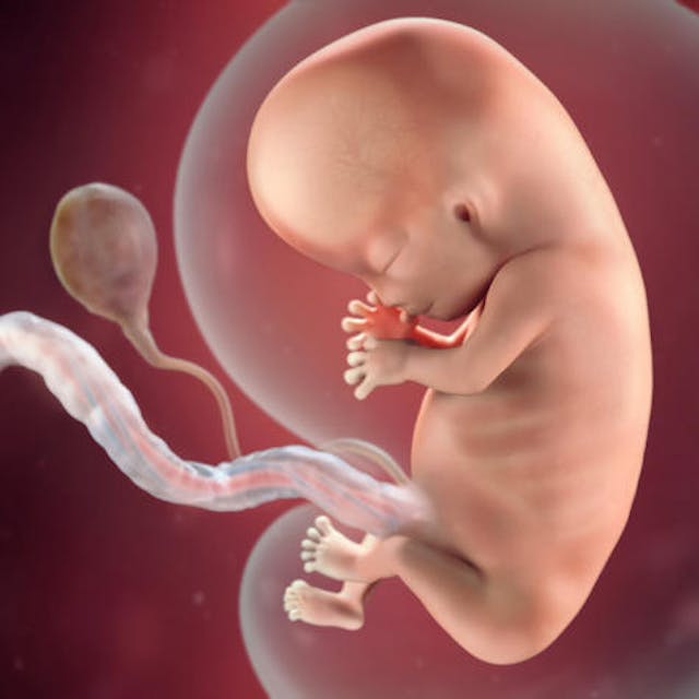 Image of 10 week baby from Babycenter.com