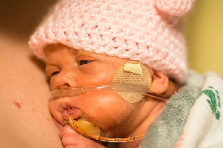 preemie, born alive