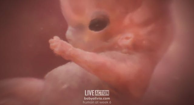 Screenshot: Baby Olivia, Week 6 (from fertilization) Meet ‘Baby Olivia’: Live Action releases groundbreaking project showcasing fetal development image