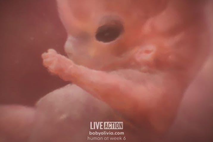 Baby Olivia, Week 6 (from fertilization) Meet ‘Baby Olivia’: Live Action releases groundbreaking project showcasing fetal development image