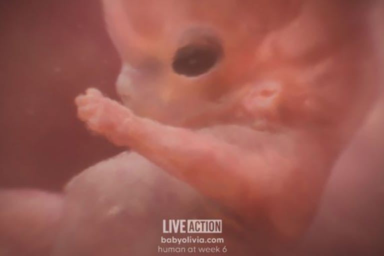 Screenshot: Baby Olivia, Week 6 (from fertilization) Meet ‘Baby Olivia’: Live Action releases groundbreaking project showcasing fetal development image