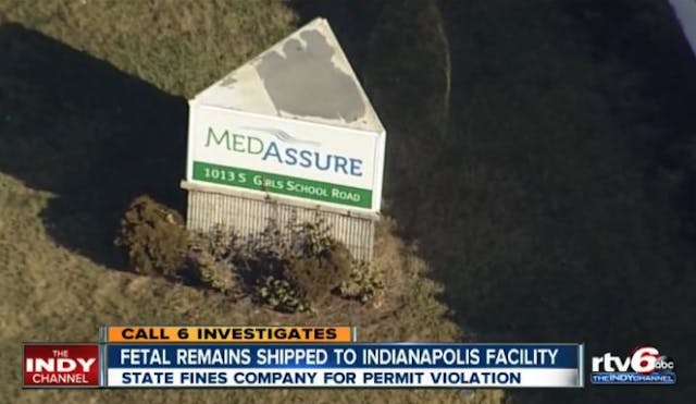 Medassure fetal aborted babies