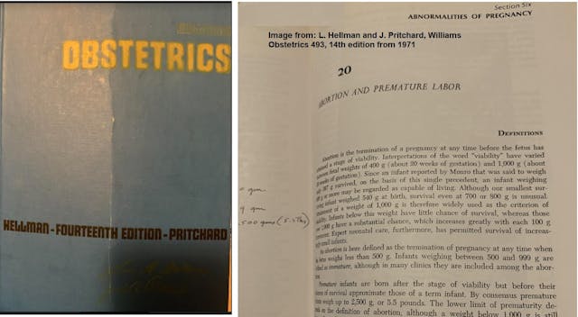 Hellman and Pritchard Williams Obstetrics 14th edition 1971 Viability and abortion Image: Hellman and Pritchard Williams Obstetrics 14th edition 1971 Viability and abortion