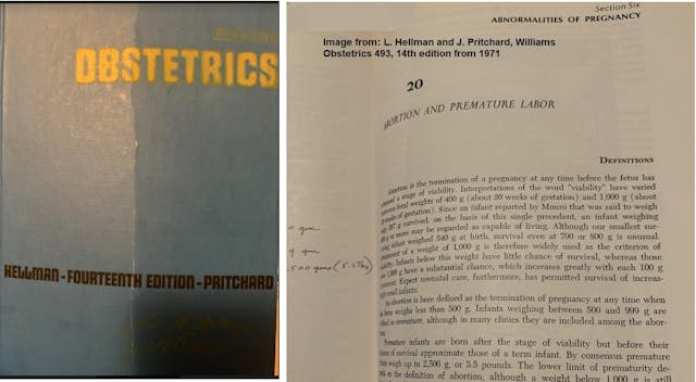Image: Hellman and Pritchard Williams Obstetrics 14th edition 1971 Viability and abortion