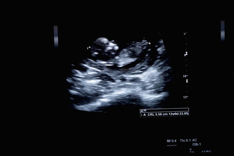 ultrasounds-baby-blue