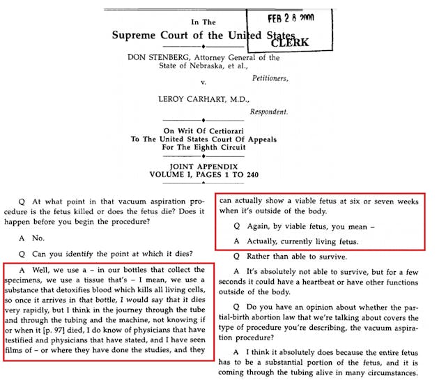 Stenberg v. Carhart – fetus sometimes aborted alive during vacuum aspiration, suction abortion Image: Stenberg V Carhart fetus sometimes aborted alive in suction aspiration abortions