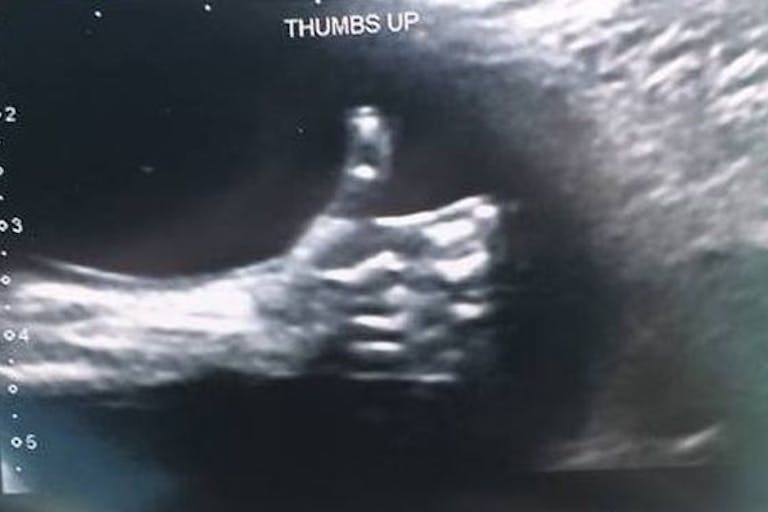 thumbs-up-ultrasound