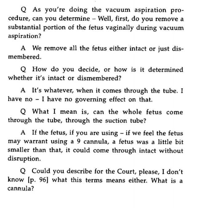 Stenberg V Carhart case abortionist removes fetus intact through suction tube in aspiration or suction abortion Image: Stenberg V Carhart case abortionist removes fetus intact through suction tube in aspiration or suction abortion