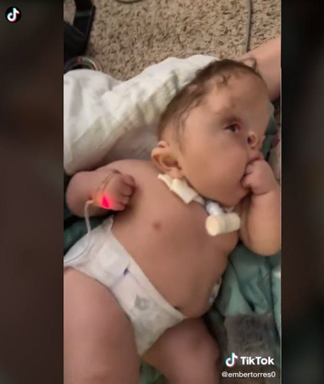 TikTok users tell mom of special needs child to ‘put it out of its misery’ image