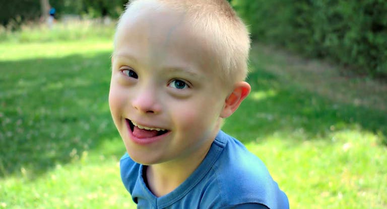 down syndrome